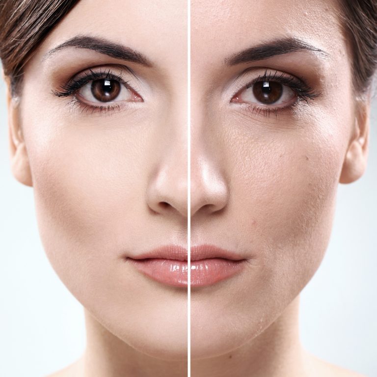 Glycolic Peel Facial Bar NY